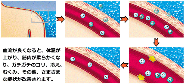 炭酸整体で血流が回復するメカニズム